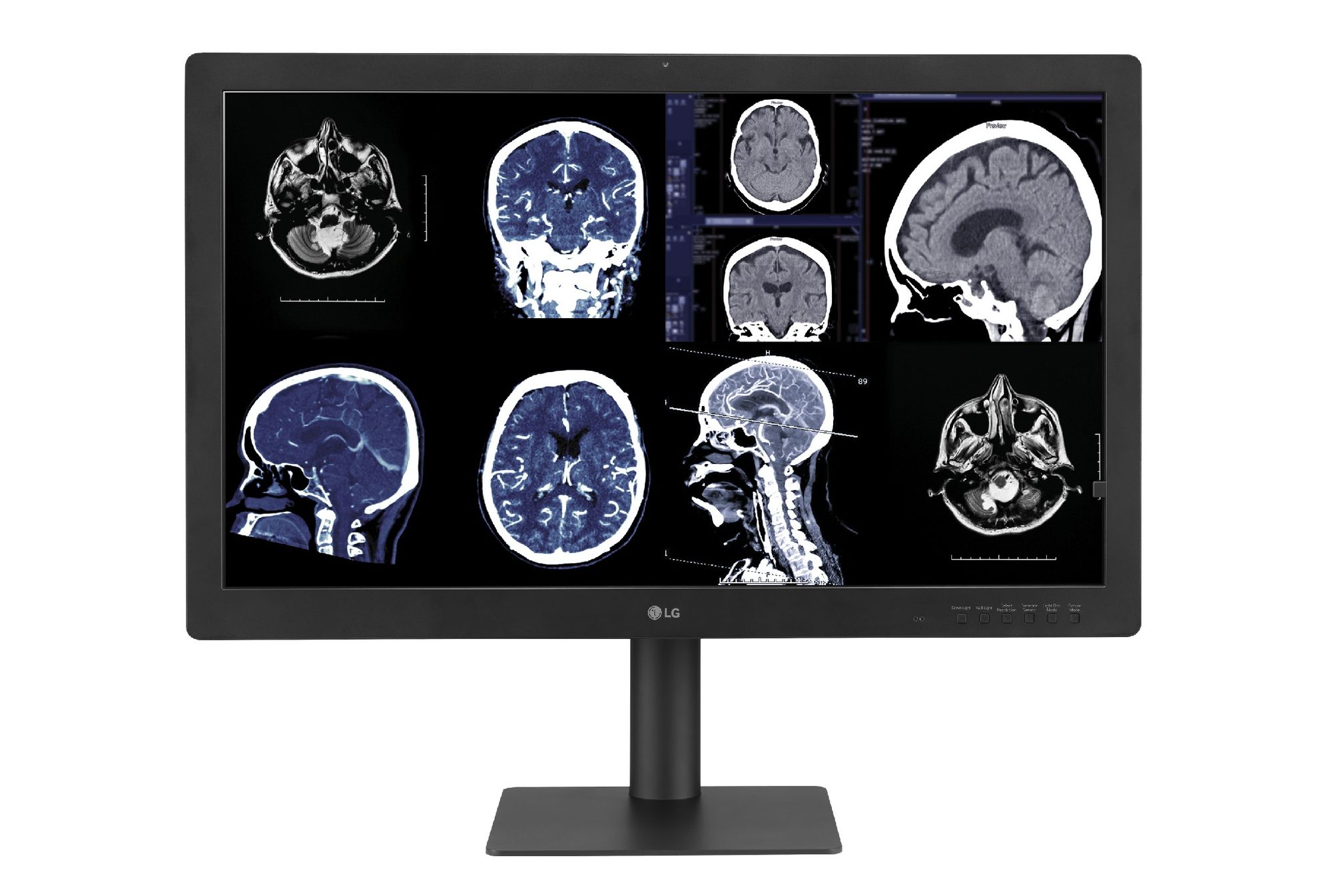 Advancing Medical Imaging: LG Launches 32HQ713D Diagnostic Monitor