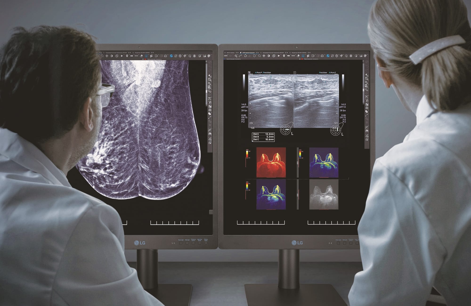 LG's New 5MP Monitor Targets Digital Mammography Market