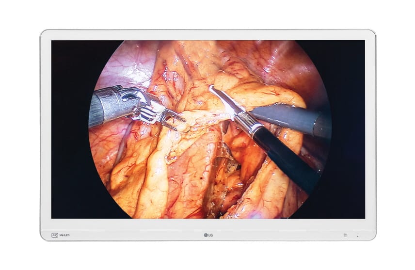 LG Electronics launches advanced surgical monitor with FDA clearance.