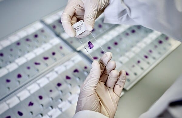 AstraZeneca, Lunit Partner on AI Cancer Mutation Detection Tool