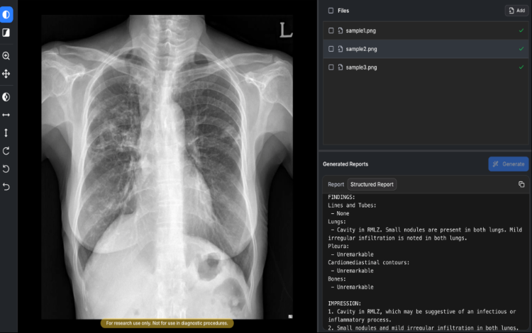 Soombit AI Secures MFDS Approval for AI Radiology Software