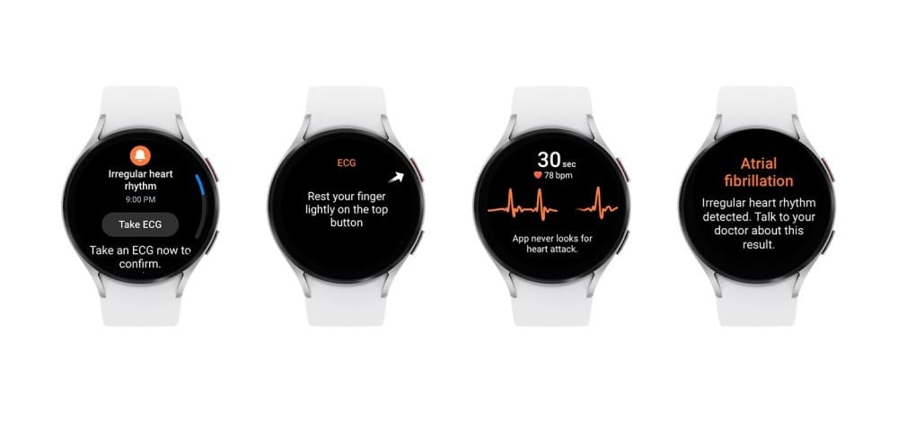 FDA Approves Samsung's Irregular Heart Rhythm Notification Tool post image